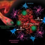 Source https://www.ncbi.nlm.nih.gov/pmc/articles/PMC2917548/ Author David Gate, Kavon Rezai-Zadeh,Dominique Jodry, Altan Rentsendorj, Terrence Town and Pietro Martinez.