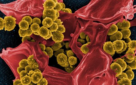 Bacteriën worden onschadelijk gemaakt door neutrofiele cel.