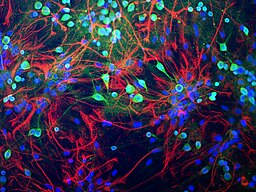De hersenen verjongen: Gezonde cellen vervangen zieke cellen